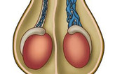 معجون واریکوسل وارداتی/طب سنتی هندی ایرانی با ده گرم ژل رویال