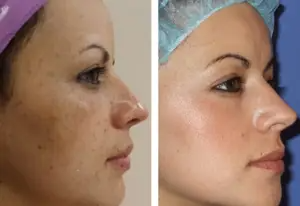 کرم شب برند لاکچری کوین فرانسه 30 میل برای روشن سازی و جوانسازی و ابرسانی پوست مستقیم از نمایندگی ایران زمین