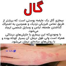 کرم ویتامین e و الوعه ورا برند ویتابلا خارجی درمان بیماری گال دوره دوماهه دوعدد کرم
