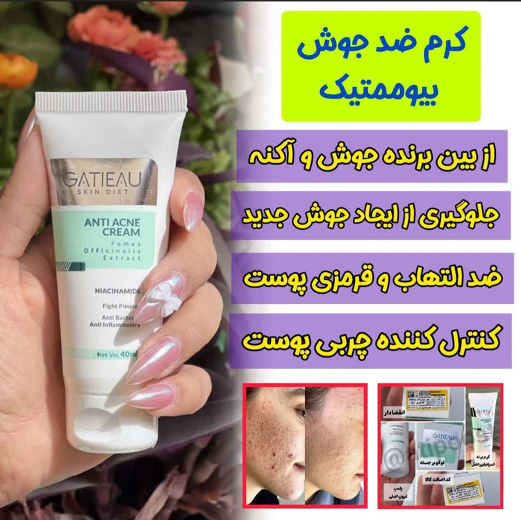 کرم بیوممتیک ضد لک 4 کاره گاتیو ایتالیا 40میل