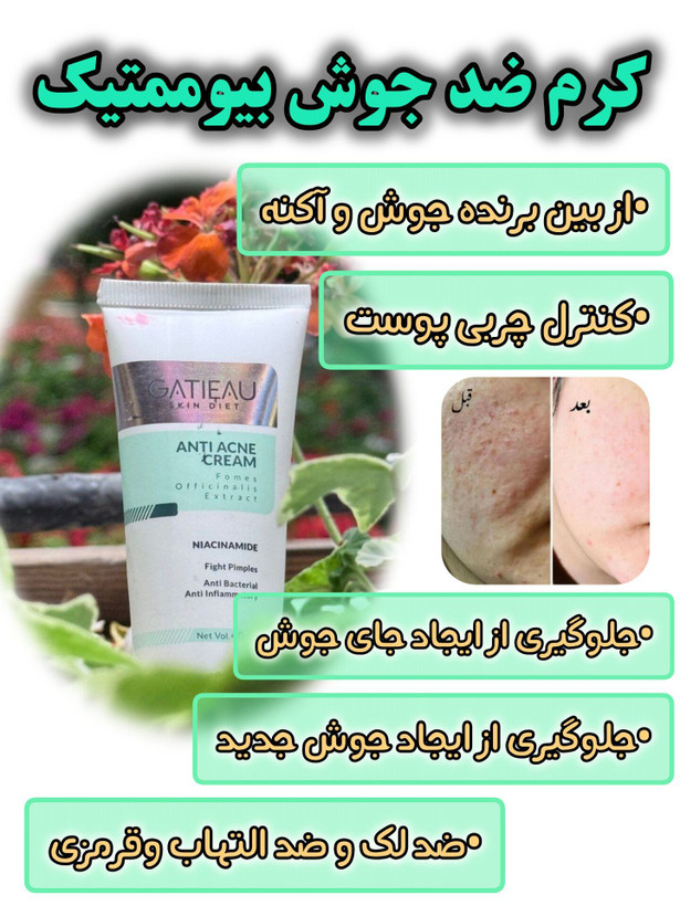 کرم بیوممتیک ضد لک 4 کاره گاتیو ایتالیا 40میل