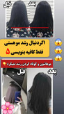 تونیک ضد ریزش و و رویش مجدد مو دوقلو برند اکسونیک-