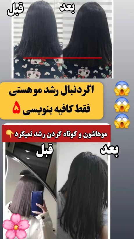 تونیک ضد ریزش و و رویش مجدد مو دوقلو برند اکسونیک-