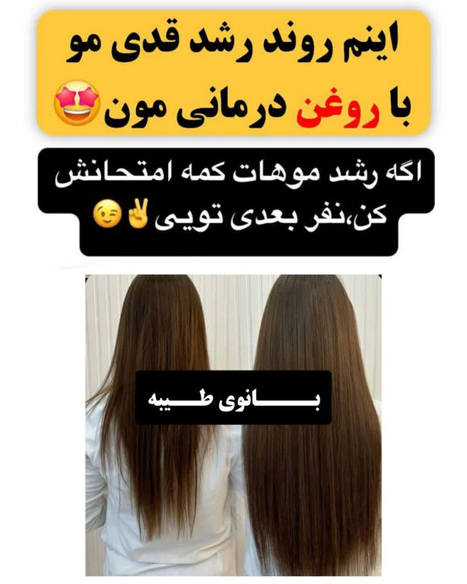 تونیک ضد ریزش و و رویش مجدد مو دوقلو برند اکسونیک-