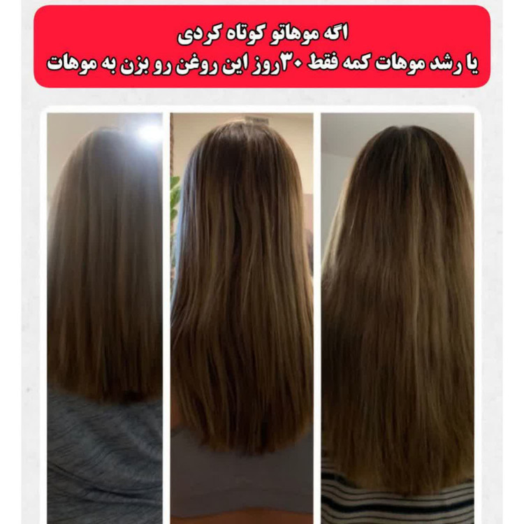 تونیک ضد ریزش و و رویش مجدد مو دوقلو برند اکسونیک-