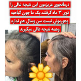 تونیک ضد ریزش و و رویش مجدد مو دوقلو برند اکسونیک-